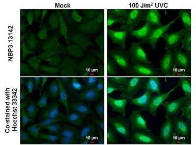 Immunocytochemistry/ Immunofluorescence: DNA-PKcs [p Ser2056] Antibody [NBP3-13142]